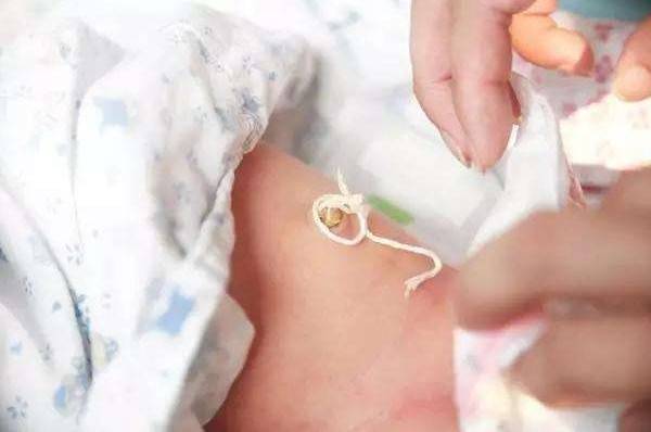 新生儿脐带消毒是个技术活，预防脐炎是关键！