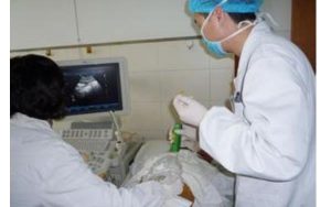 幼儿睾丸鞘膜积液手术的成功率