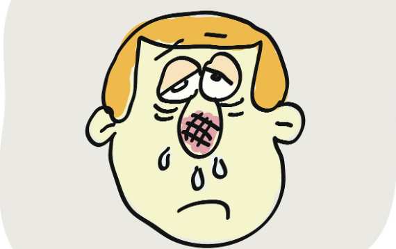 鼻炎有什么征兆